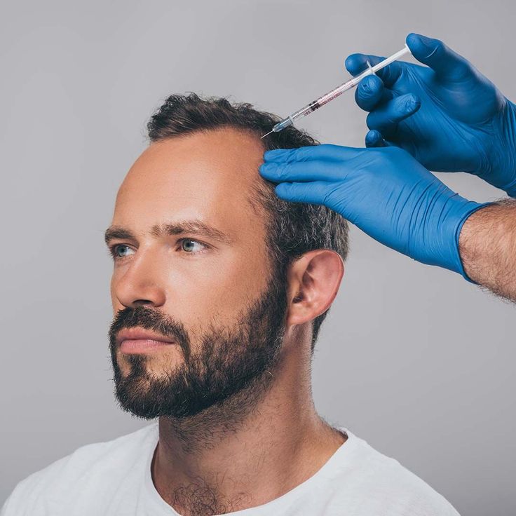 PRP Treatment